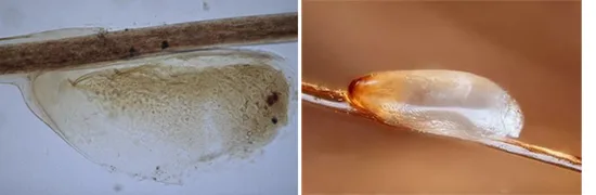 Как правильно вести себя, если появились вши 4 image 3